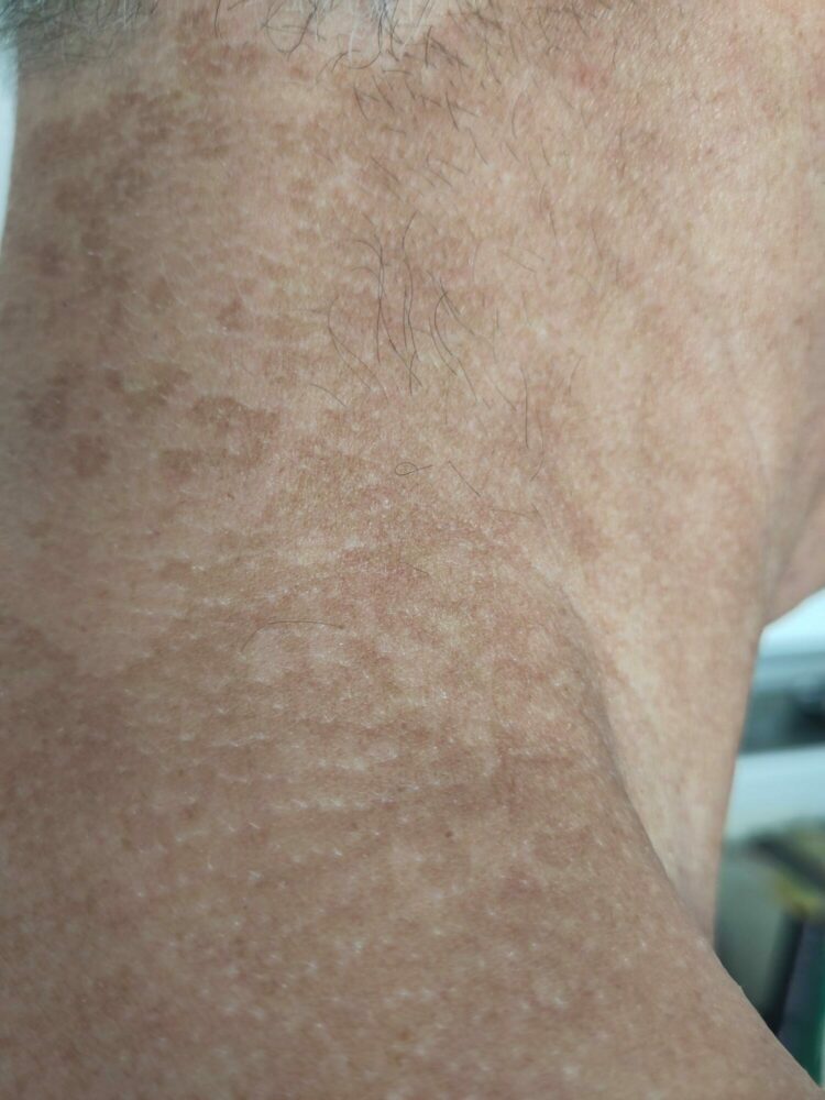 Les effets nocifs des parfums sur la peau